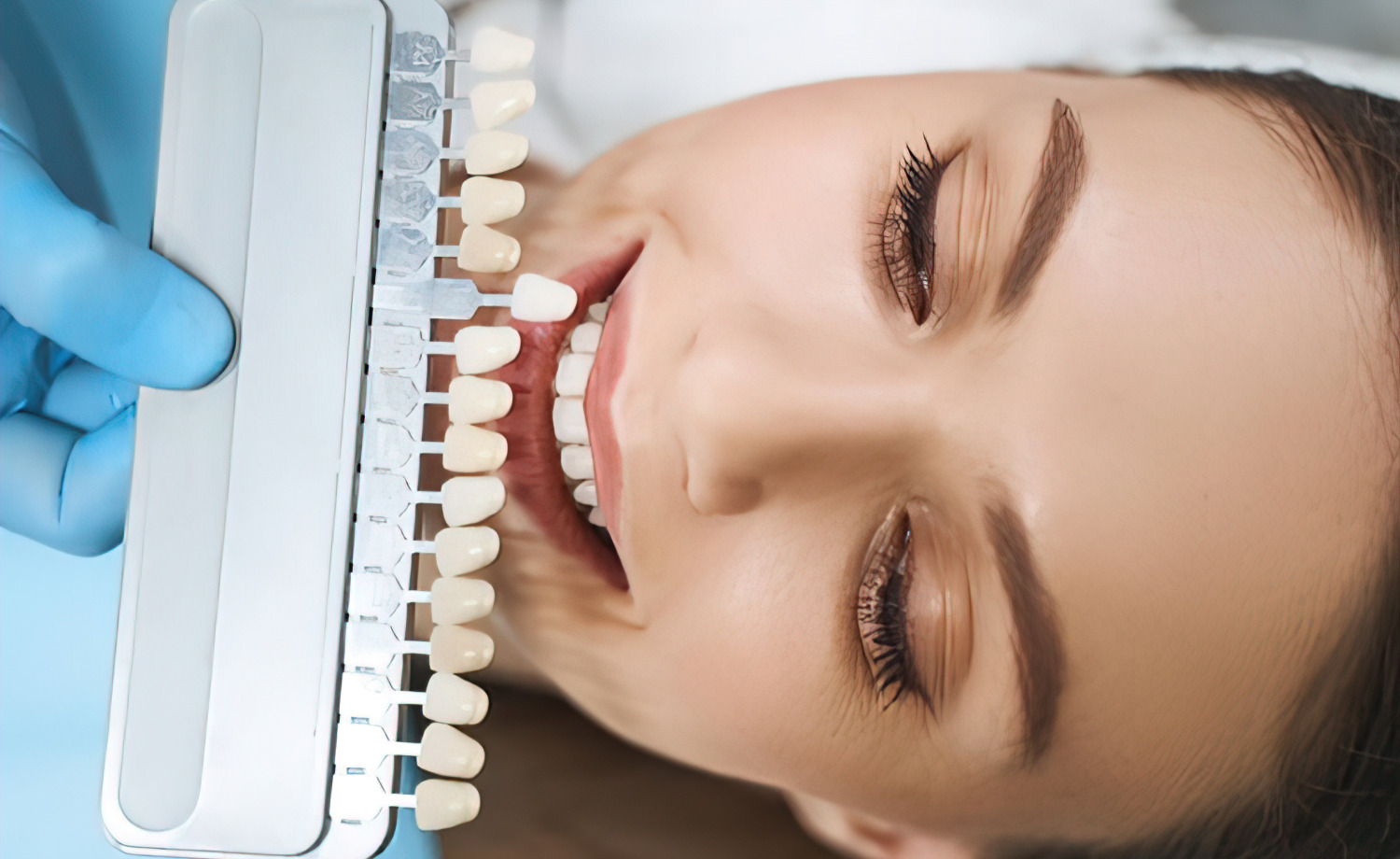 What We should Know about the Dental Veneer?