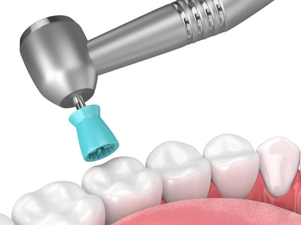 Benefits and Types of Tooth Polishing