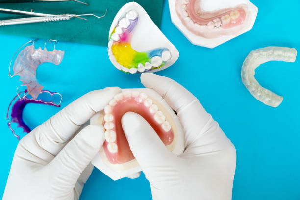 How Are Dentures Made?