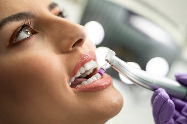 How to Properly Choose and Use Polishing Brushes for a Bright and Shiny Smile?