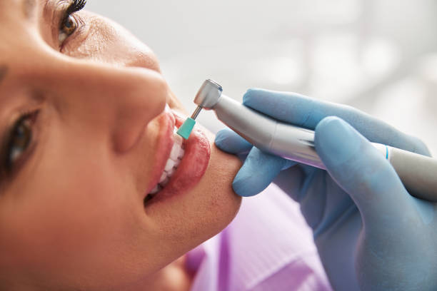 Dental polishing cups and brushes