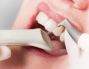 Air abrasion dental tool in use