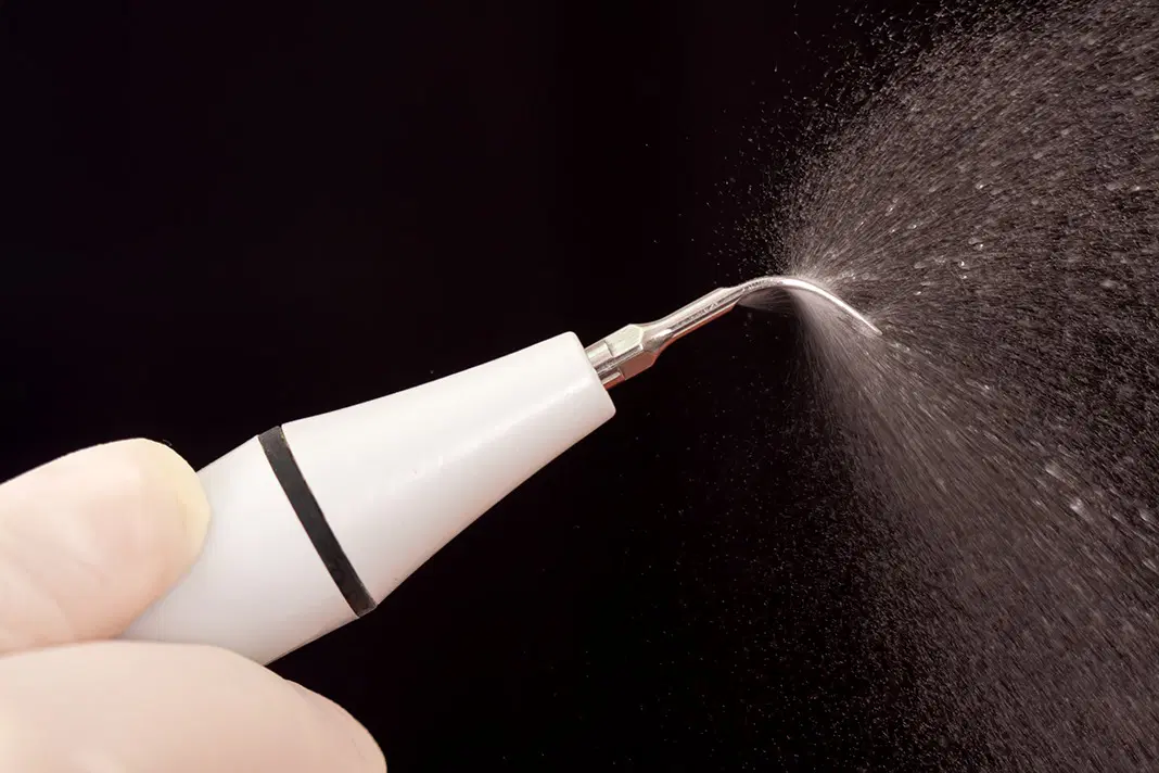 Ultrasonic scaler removing dental calculus