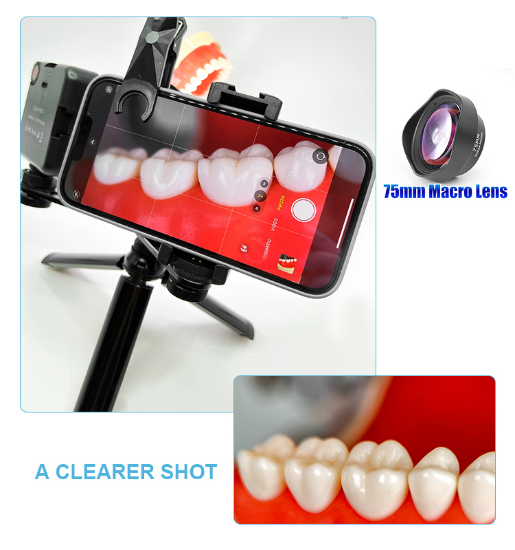 Enhancing Diagnosis and Treatment Planning with Dental Mobile Photography Lamps