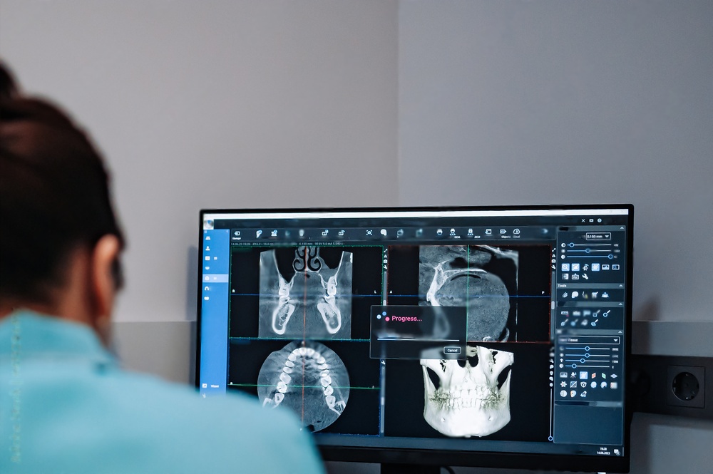 Benefits of Digital Dental X-ray Sensors