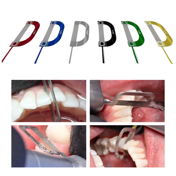 OS40 Diamond Ortho Strip Manual