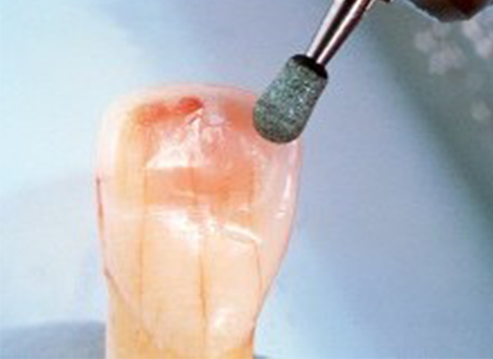 Imagen descriptiva de piedra verde CN1-FG 2