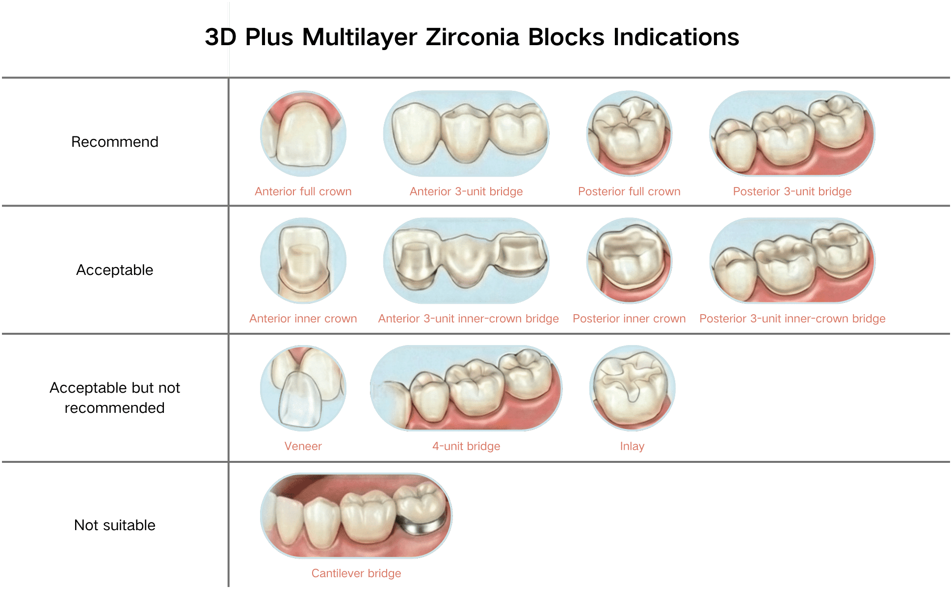 3DP zirconia indications