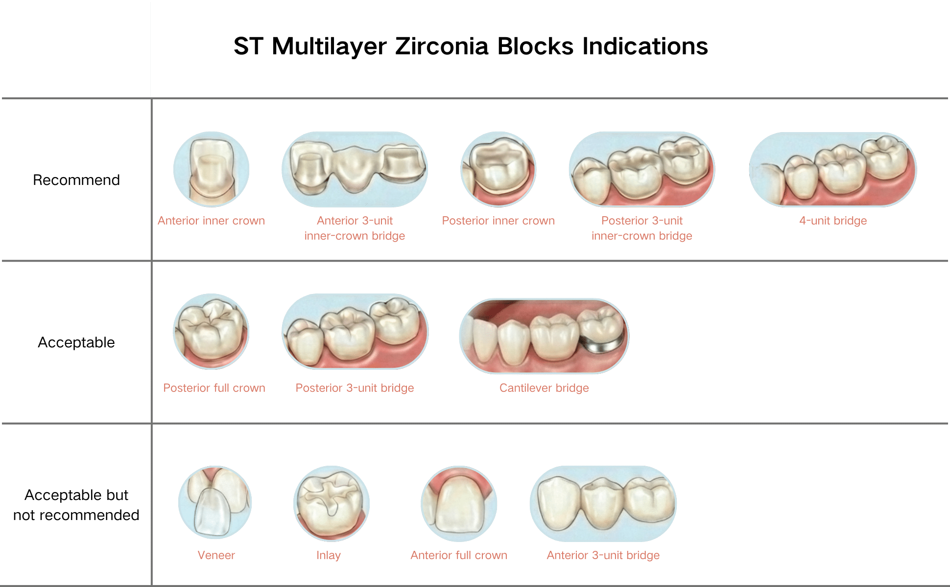 Zirconia block indications