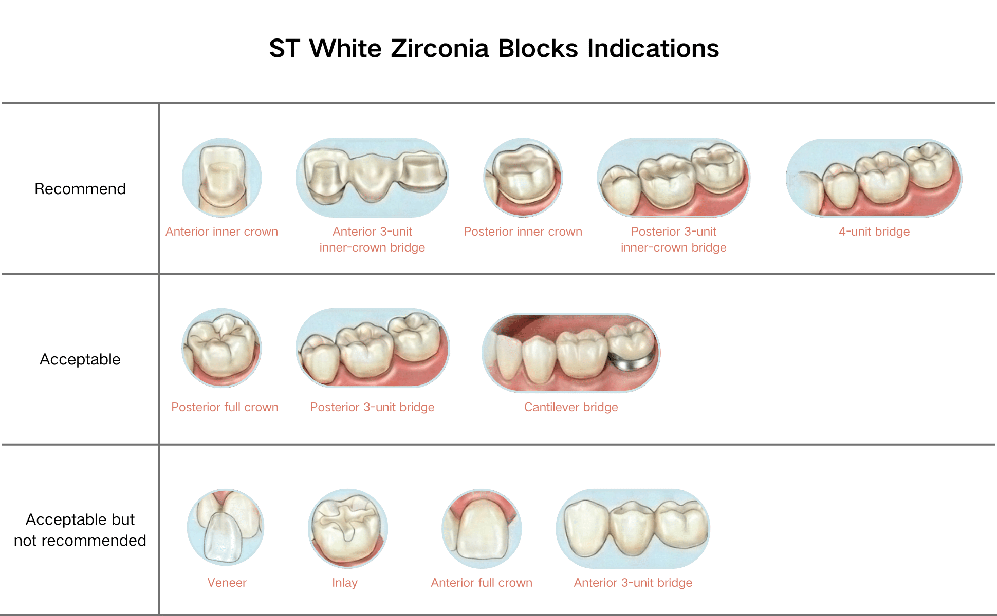 Zirconia block indications