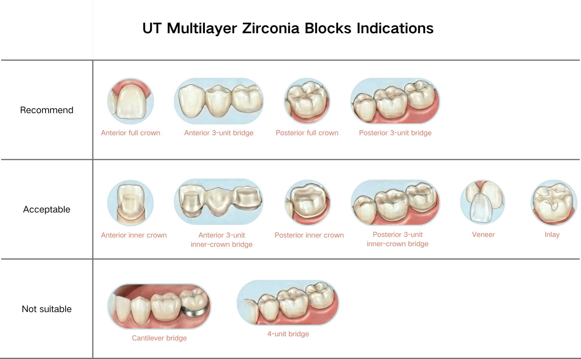 Zirconia block indications